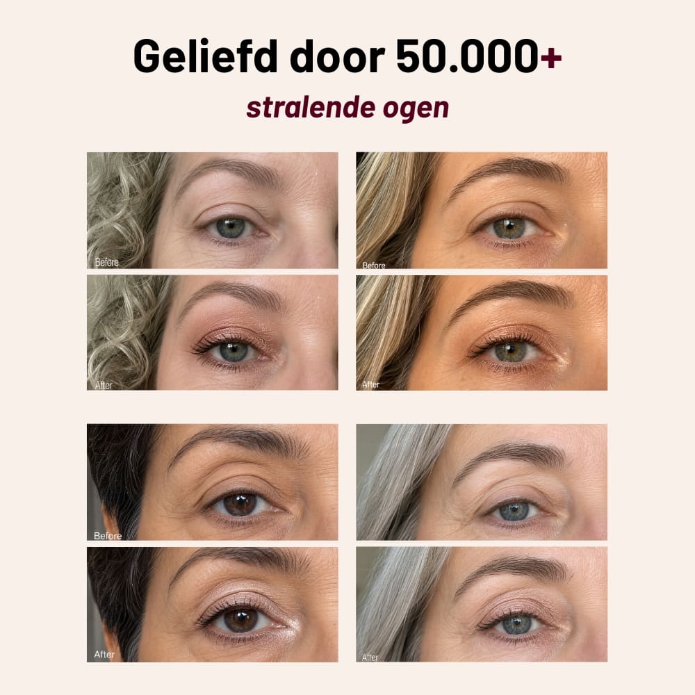 Eye Duo Set - Image 10